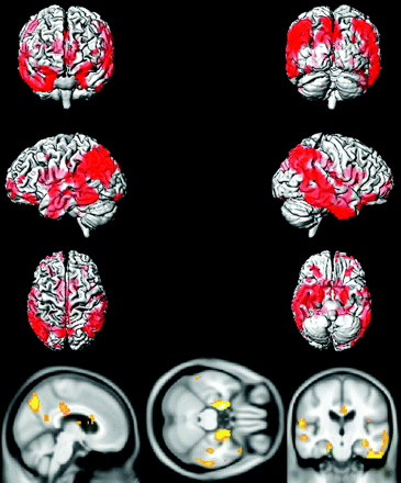 Fig 3.