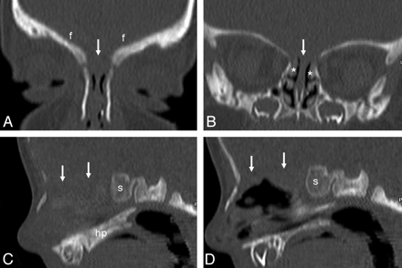 Fig 6.