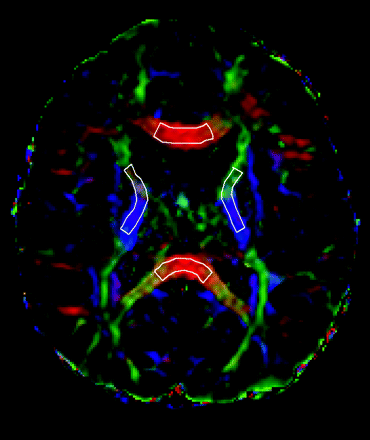 Fig 2.