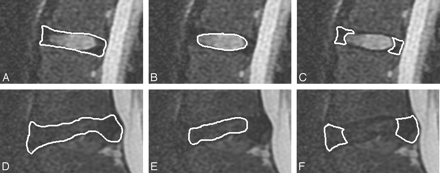 Fig 2.