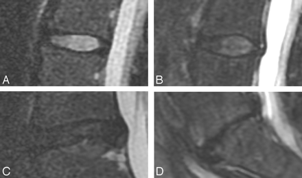 Fig 3.