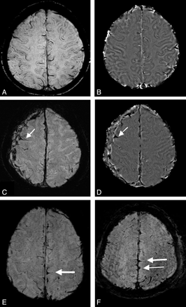 Fig 6.