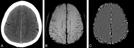 Fig 8.
