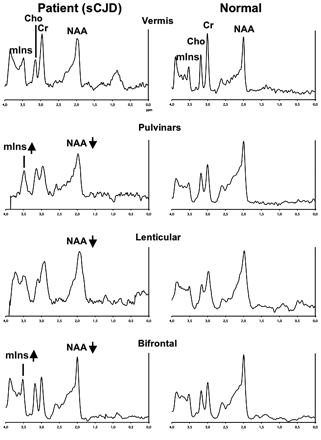 Fig 3.