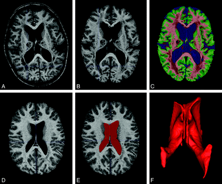 Fig 3.