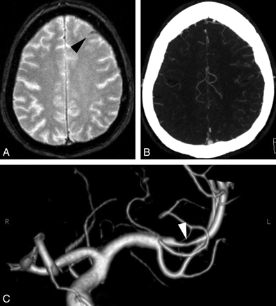 Fig 6.