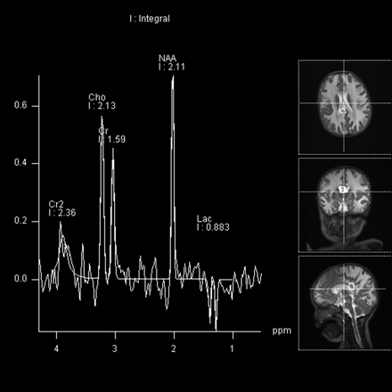 Fig 4.