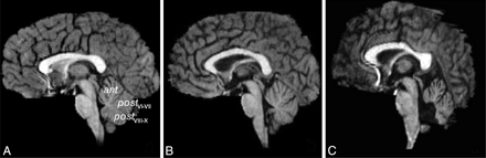 Fig 1.