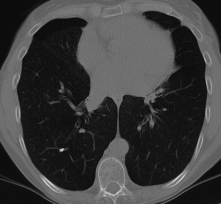 Fig 2.
