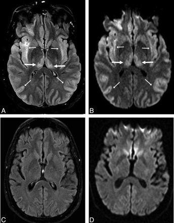 Fig 4.