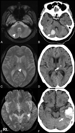 Fig 1.