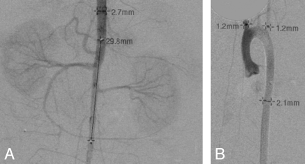 Fig 3.