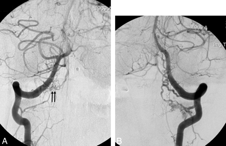 Fig 2.