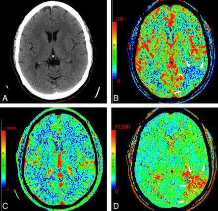Fig 3.