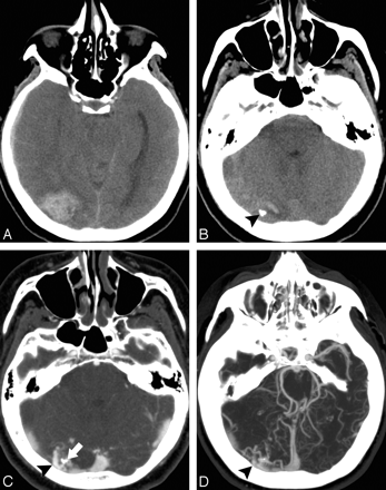 Fig 1.