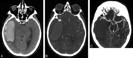 Fig 2.