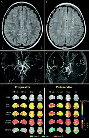 Fig 4.