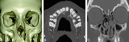 Fig 4.