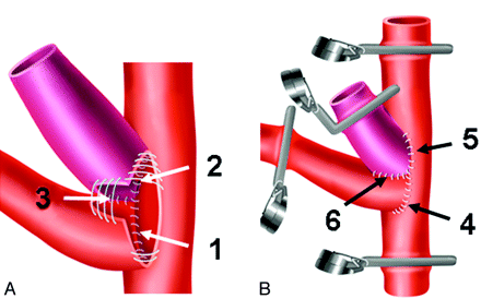 Fig 1.