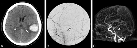 Fig 1.