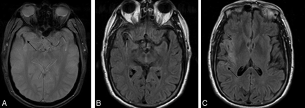 Fig 1.