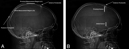 Fig 1.