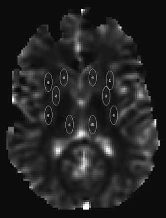 Fig 1.