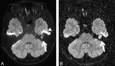 Fig 1.