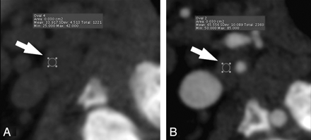 Fig 1.