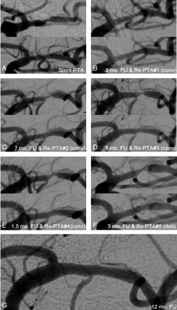 Fig 2.