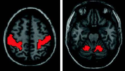 Fig 1.