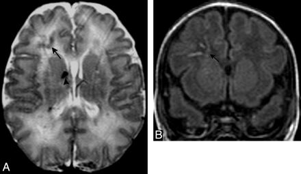 Fig 2.