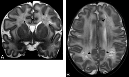 Fig 3.