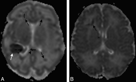 Fig 4.