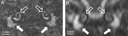 Fig 1.