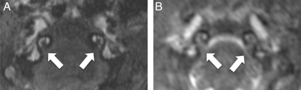 Fig 2.