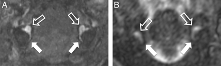 Fig 3.