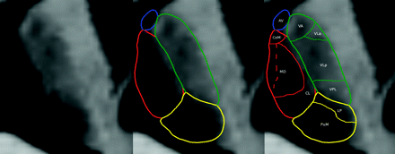 Fig 5.