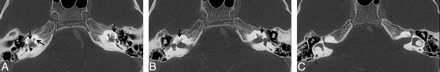 Fig 3.