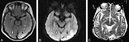 Fig 2.
