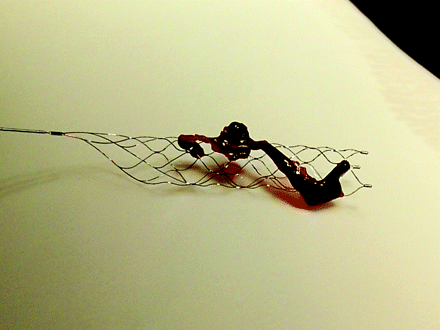 Fig 3.