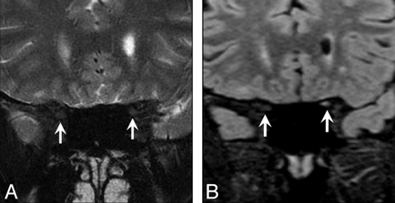 Fig 4.