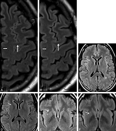 Fig 4.