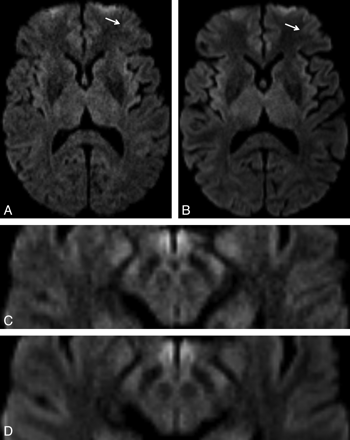 Fig 5.