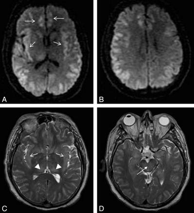 Fig 3.