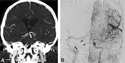 Fig 3.