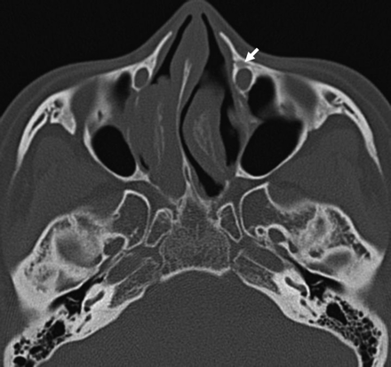 Fig 2.