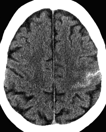 Fig 1.