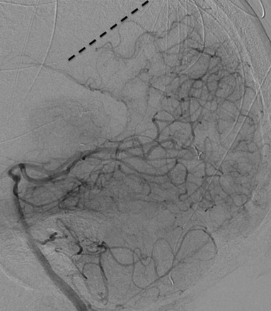 Fig 3.