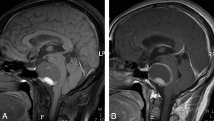 Fig 1.